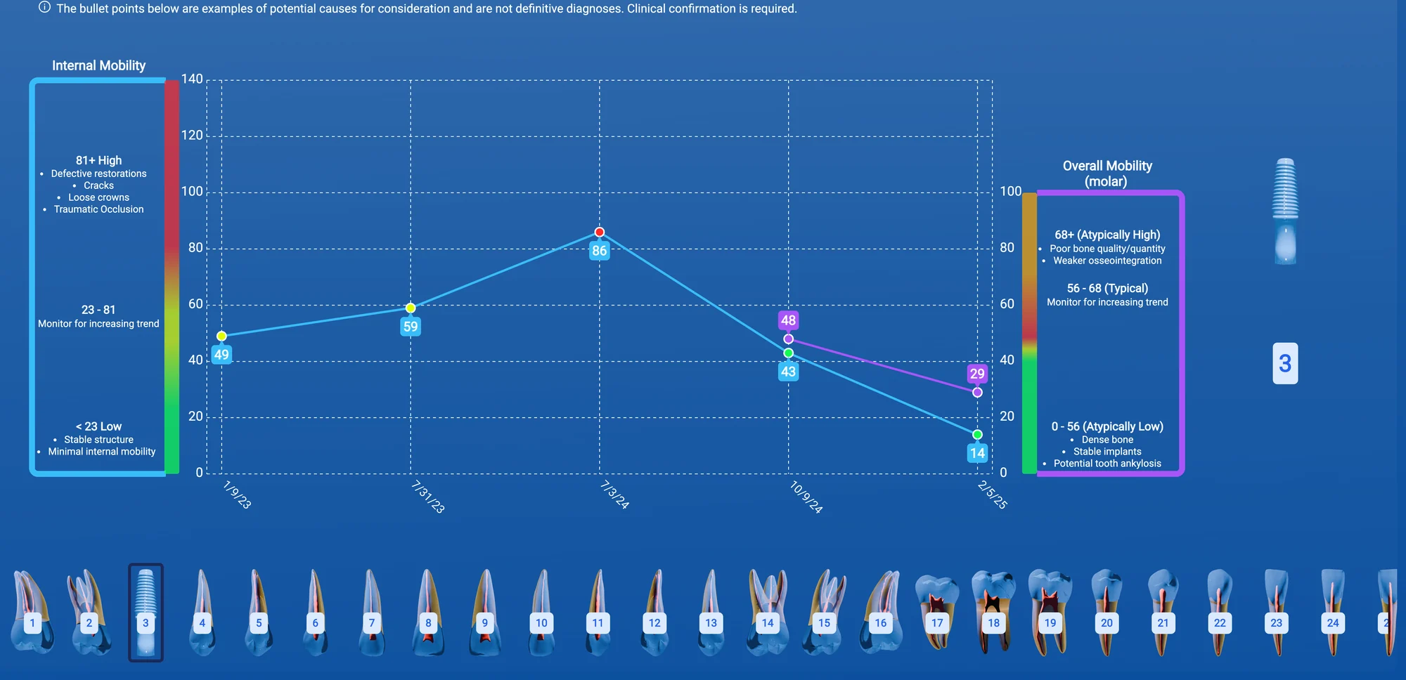 InnerView internal and overall mobility readings for an implant tracked over several visits