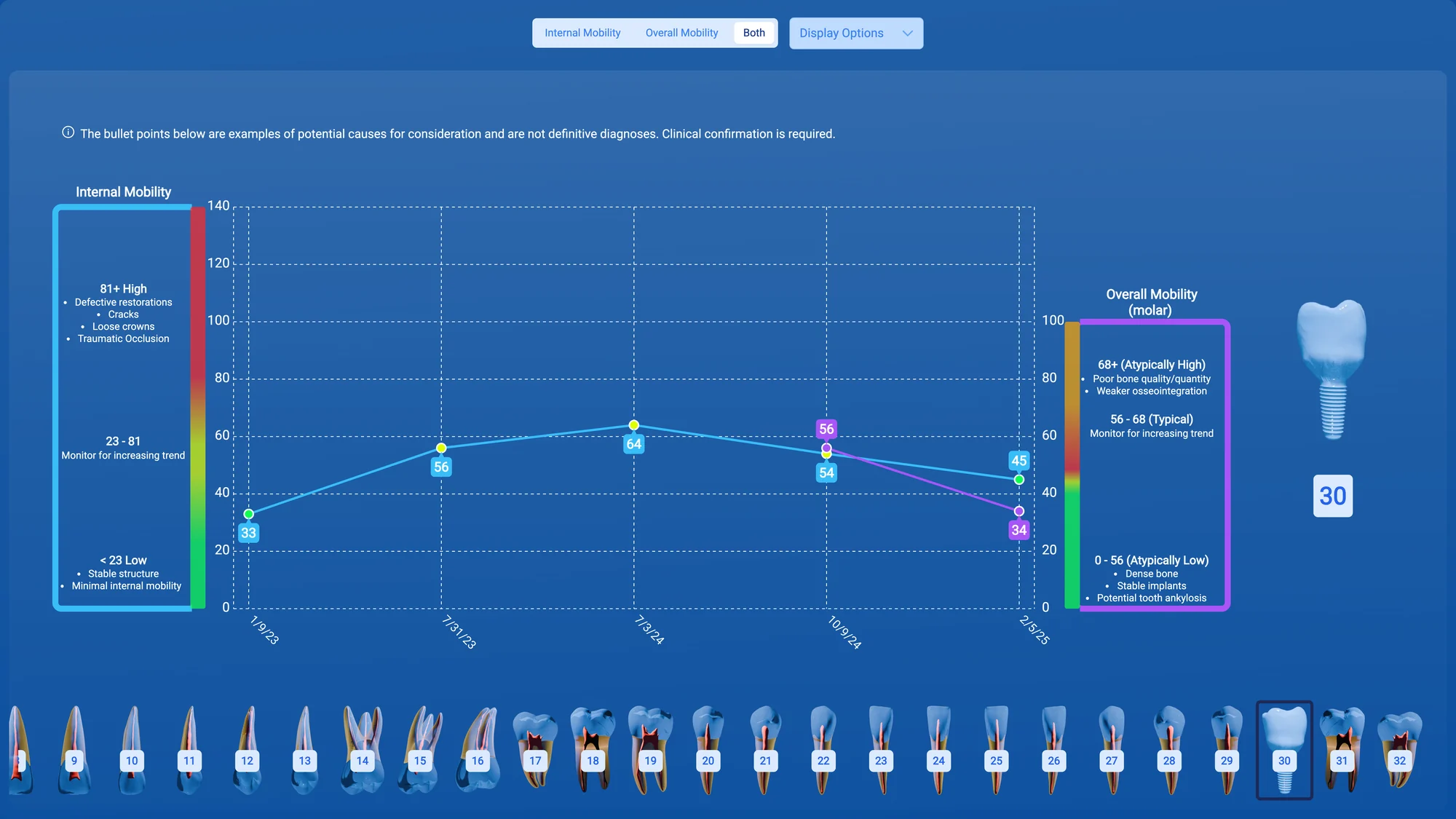InnerView internal and overall mobility trendlines for one implant across visits