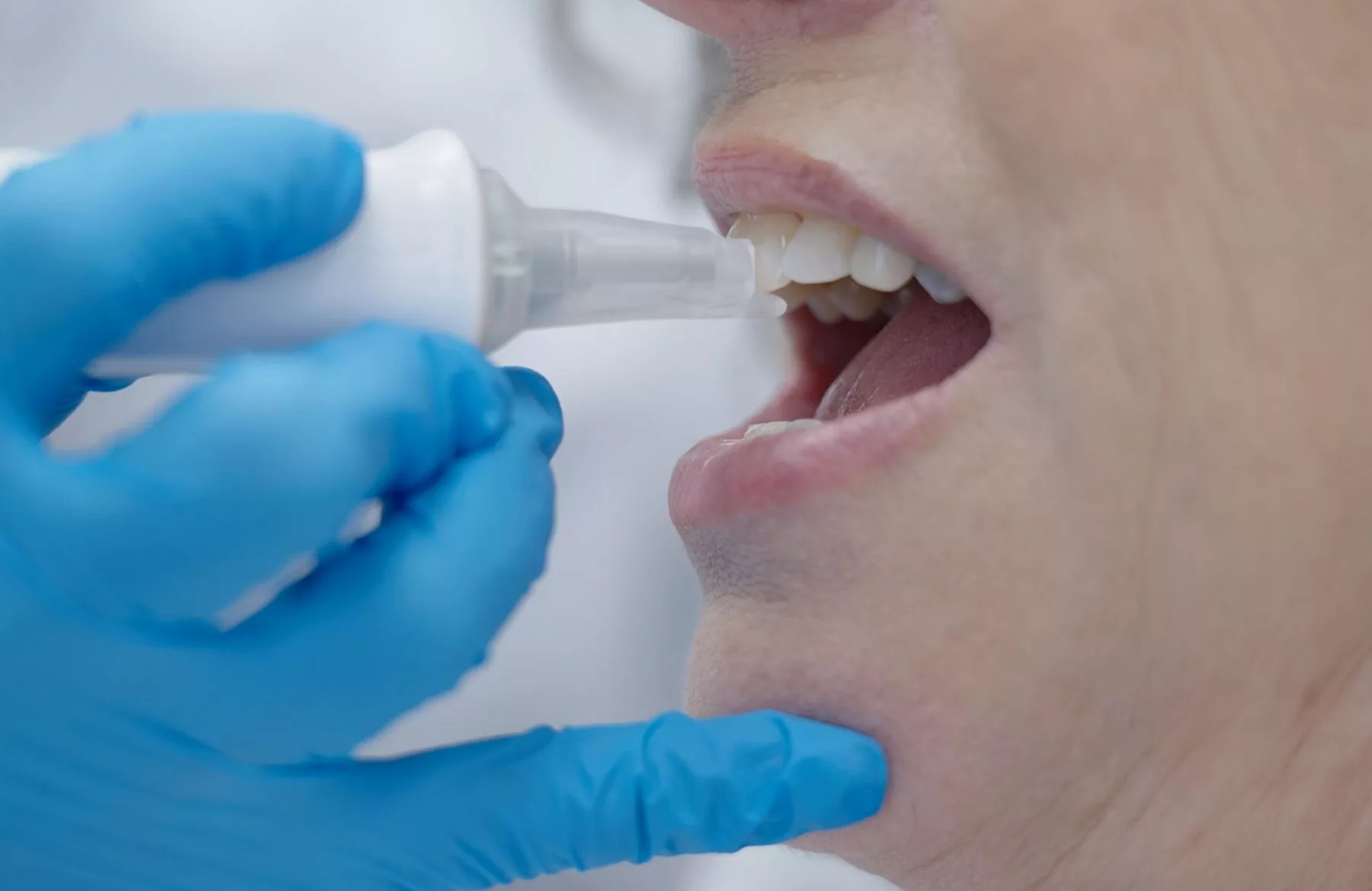 Clinician measuring an upper tooth with InnerView